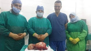 فريق طبى بأورام طنطا ينجح فل استئصال ورم سرطانى من رحم سيده يزن 11 كيلو