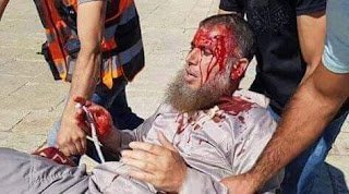 من جديد.. الاحتلال يعتدي على مصلي عيد الأضحى بالمسجد الأقصى ( وصور)