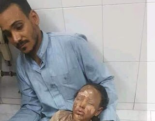 شاب يشعل النار بحفل زفاف خطيبته السابقة بالفيوم وإصابة 15 من المعازيم
