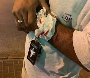 وافدون يعتدون على مفتشي اللجنة الثلاثية بآلات حادة بسوق السمك بالكويت