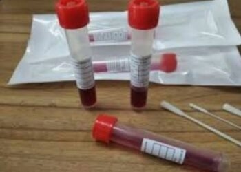 الصين المسحة الشرجية أكثر دقة في إكتشاف فيروس كورونا