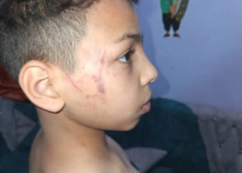 بعد تعديها على طفل بالضرب المبرح محافظ سوهاج يقرر إيقاف معلمة واقعة “مدرسة دار السلام”...