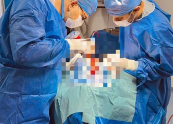 نجاح إنقاذ طفل من مضاعفات خطيرة بعد كسر بالجمجمة بتنسيق عاجل بين مستشفيي تمي الأمديد...